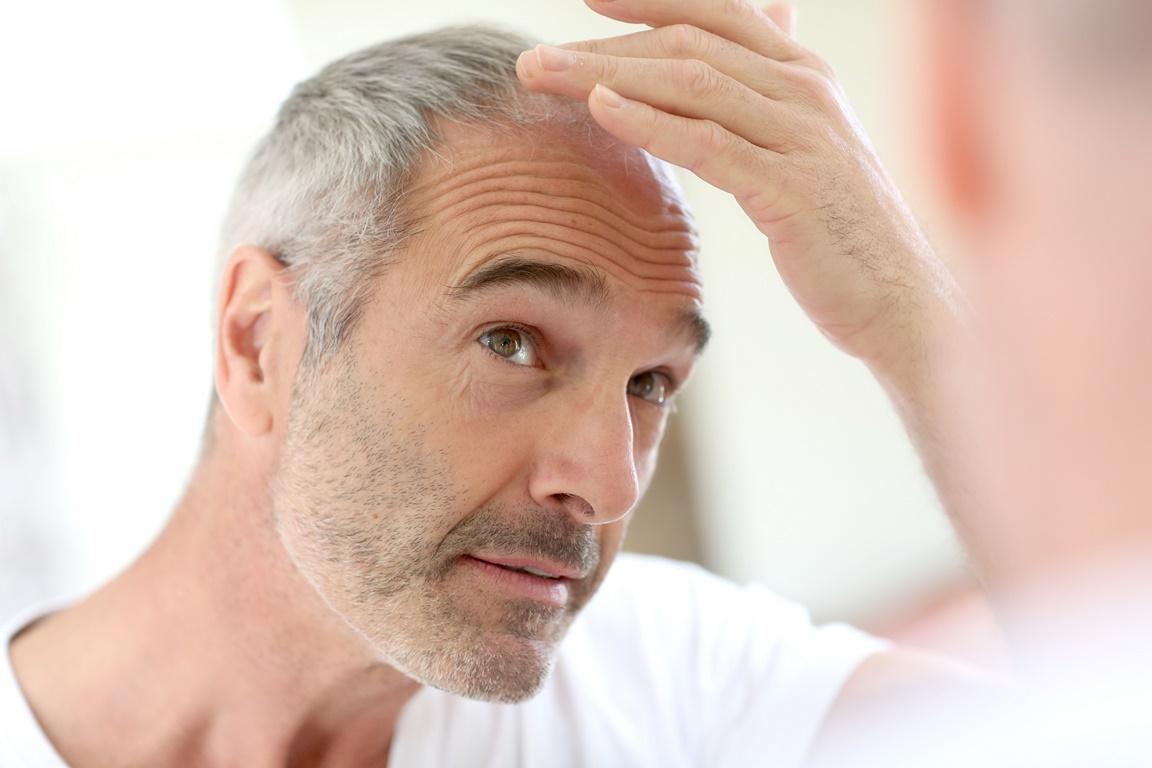 FUE Hair Transplant